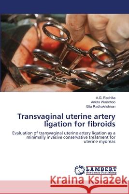 Transvaginal uterine artery ligation for fibroids Radhika, A. G. 9783659123030 LAP Lambert Academic Publishing - książka