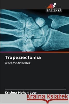 Trapeziectomia Krishna Mohan Lyer 9786207698110 Edizioni Sapienza - książka