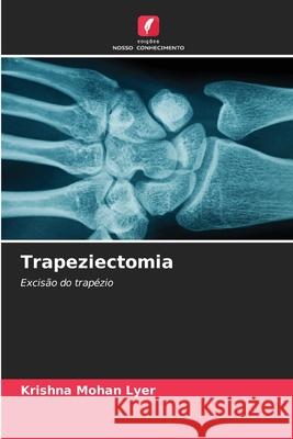 Trapeziectomia Krishna Mohan Lyer 9786207698127 Edicoes Nosso Conhecimento - książka