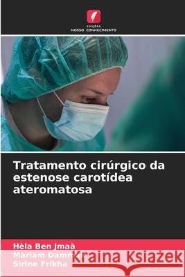 Tratamento cir?rgico da estenose carot?dea ateromatosa H?la Be Mariam Dammak Sirine Frikha 9786207788958 Edicoes Nosso Conhecimento - książka