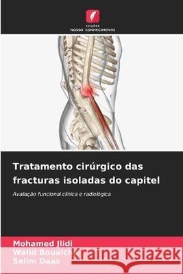 Tratamento cir?rgico das fracturas isoladas do capitel Mohamed Jlidi Walid Bouaicha Selim Daas 9786207897629 Edicoes Nosso Conhecimento - książka