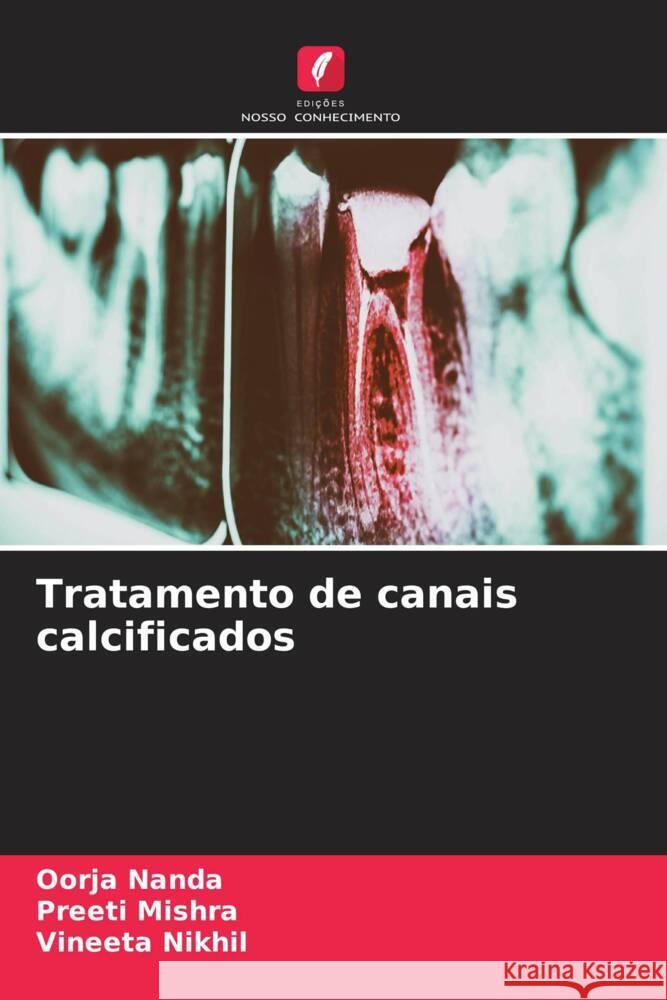 Tratamento de canais calcificados Nanda, Oorja, Mishra, Preeti, Nikhil, Vineeta 9786208197537 Edições Nosso Conhecimento - książka