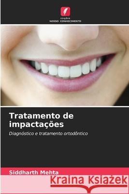 Tratamento de impactações Mehta, Siddharth 9786209551147 Edições Nosso Conhecimento - książka