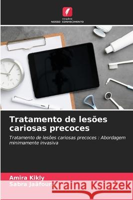 Tratamento de les?es cariosas precoces Amira Kikly Sabra Ja?foura 9786207714186 Edicoes Nosso Conhecimento - książka