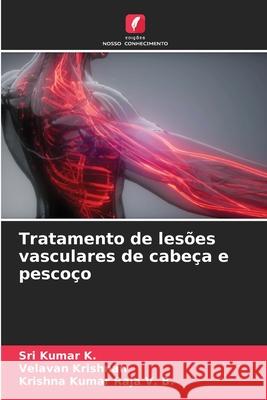 Tratamento de les?es vasculares de cabe?a e pesco?o Sri Kumar K Velavan Krishnan Krishna Kumar Raja V 9786207787050 Edicoes Nosso Conhecimento - książka