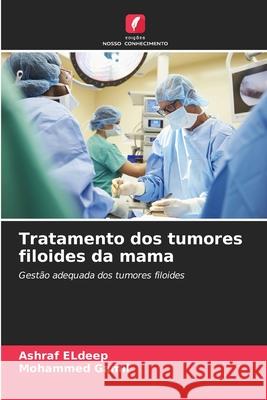 Tratamento dos tumores filoides da mama Eldeep, Ashraf, Gamil, Mohammed 9786209252051 Edições Nosso Conhecimento - książka