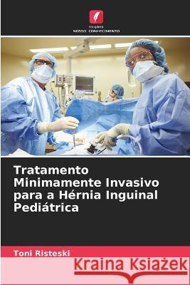 Tratamento Minimamente Invasivo para a Hernia Inguinal Pediatrica Toni Risteski   9786205815243 Edicoes Nosso Conhecimento - książka