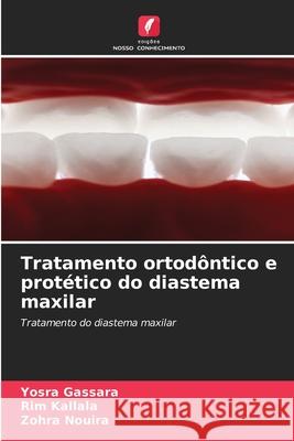 Tratamento ortod?ntico e prot?tico do diastema maxilar Yosra Gassara Rim Kallala Zohra Nouira 9786207914920 Edicoes Nosso Conhecimento - książka