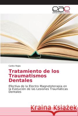 Tratamiento de los Traumatismos Dentales Rojas, Carlos 9786202146074 Editorial Académica Española - książka