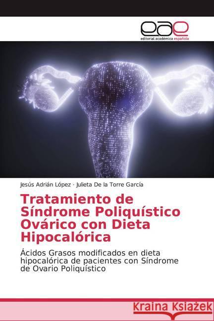 Tratamiento de Síndrome Poliquístico Ovárico con Dieta Hipocalórica : Ácidos Grasos modificados en dieta hipocalórica de pacientes con Síndrome de Ovario Poliquístico LÓPEZ, JESÚS ADRIÁN; De la Torre García, Julieta 9786200377289 Editorial Académica Española - książka