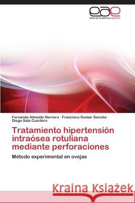 Tratamiento hipertensión intraósea rotuliana mediante perforaciones Almeida Herrero Fernando 9783844337754 Editorial Academica Espanola - książka