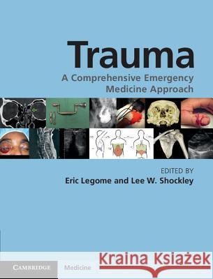 Trauma: A Comprehensive Emergency Medicine Approach Legome, Eric 9780521870573  - książka