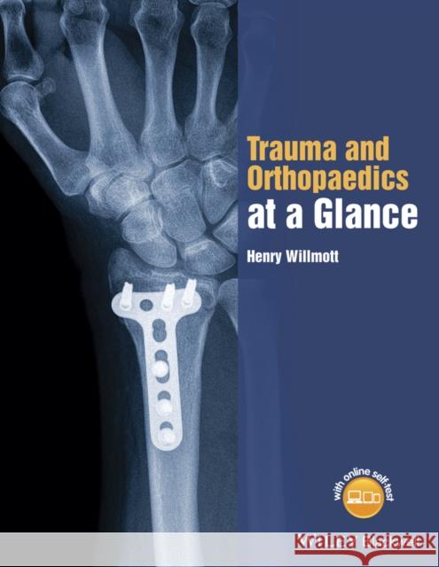 Trauma and Orthopaedics at a Glance Willmott, Henry 9781118802533 John Wiley & Sons - książka