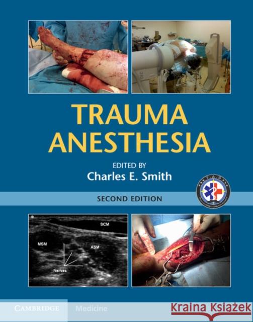 Trauma Anesthesia Charles Smith 9781107038264 Cambridge University Press - książka