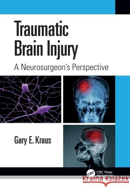 Traumatic Brain Injury: A Neurosurgeon's Perspective Gary Kraus 9781032394893 CRC Press - książka