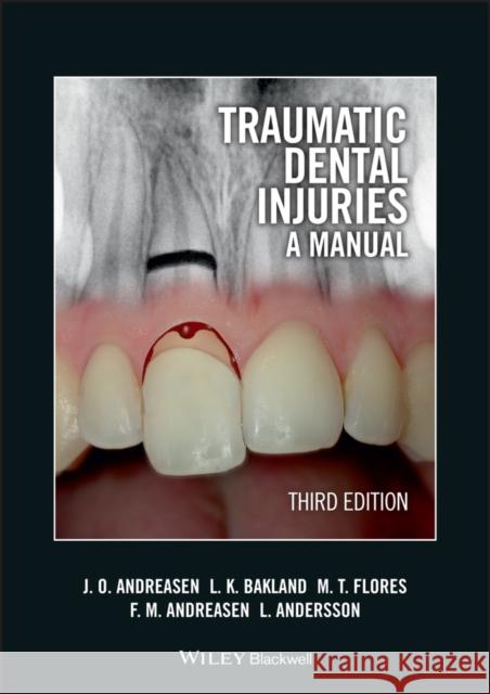 Traumatic Dental Injuries: A Manual [With DVD ROM] Andreasen, Jens O. 9781405190619  - książka