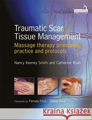 Traumatic Scar Tissue Management: Principles and Practice for Manual Therapy Catherine Ryan 9781909141223 Jessica Kingsley Publishers - książka