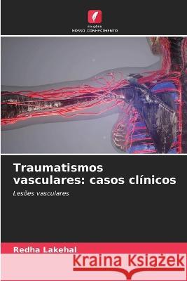 Traumatismos vasculares: casos clínicos Redha Lakehal 9786205355527 Edicoes Nosso Conhecimento - książka