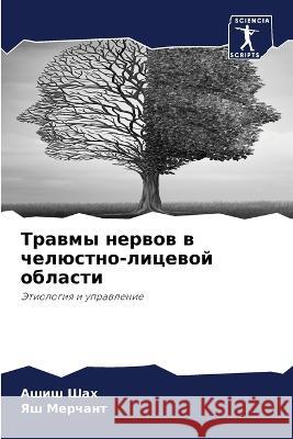 Trawmy nerwow w chelüstno-licewoj oblasti Shah, Ashish, Merchant, Yash 9786205800553 Sciencia Scripts - książka