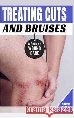 Treating Cuts and Bruises: A Book on Wound Care Paolo Jos 9781530000593 Createspace Independent Publishing Platform - książka