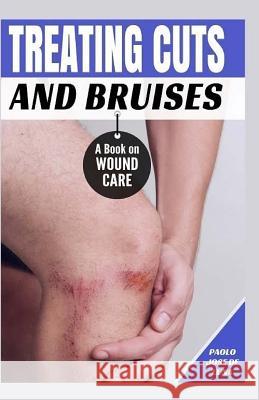 Treating Cuts and Bruises: A Book on Wound Care Paolo Jos 9781530000920 Createspace Independent Publishing Platform - książka
