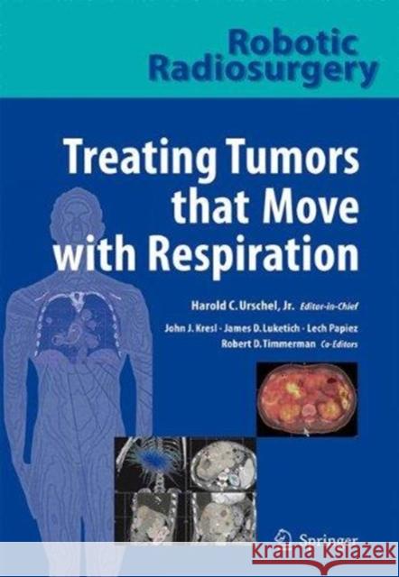 Treating Tumors That Move with Respiration Kresl, John J. 9783662501054 Springer - książka