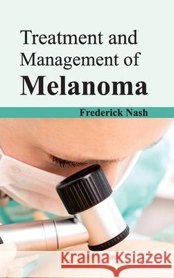 Treatment and Management of Melanoma Frederick Nash 9781632424082 Foster Academics - książka