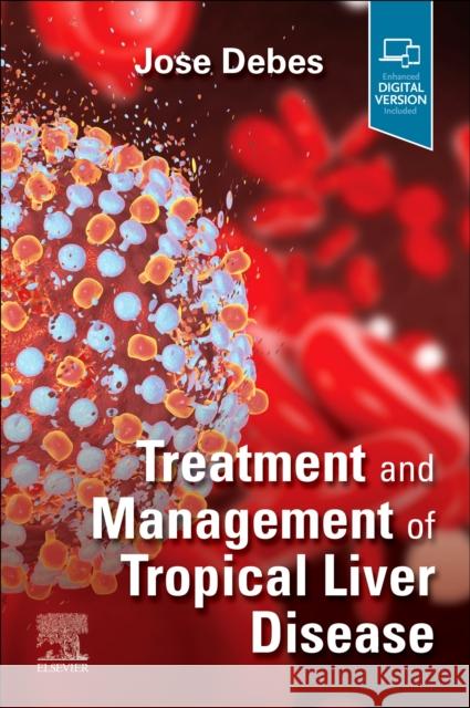 Treatment and Management of Tropical Liver Disease  9780323870313 Elsevier - Health Sciences Division - książka