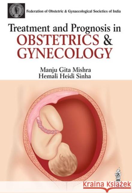 Treatment and Prognosis in Obstetrics & Gynecology Manju Gita Mishra 9789351521624 Jp Medical Ltd - książka