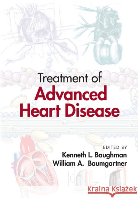 Treatment of Advanced Heart Disease Kenneth Le Baughman Baughman Lee Baughman Kenneth L. Baughman 9780849338267 Informa Healthcare - książka