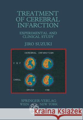 Treatment of Cerebral Infarction: Experimental and Clinical Study Suzuki, Jiro 9783709188637 Springer - książka
