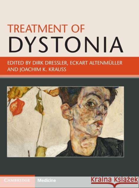 Treatment of Dystonia Dirk Dressler Eckart Altenmuller Joachim K. Krauss 9781107132863 Cambridge University Press - książka