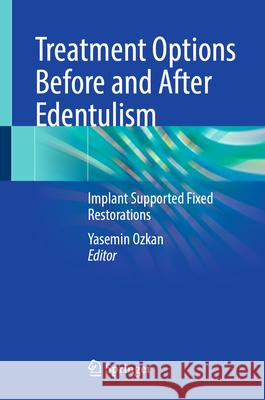 Treatment Options Before and After Edentulism: Implant Supported Fixed Restorations Yasemin ?zkan 9783031968785 Springer - książka