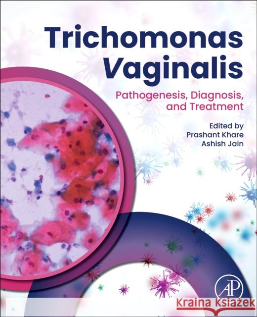Trichomonas Vaginalis: Pathogenesis, Diagnosis, and Treatment Prashant Khare Ashish Jain 9780443222047 Elsevier Science Publishing Co Inc - książka