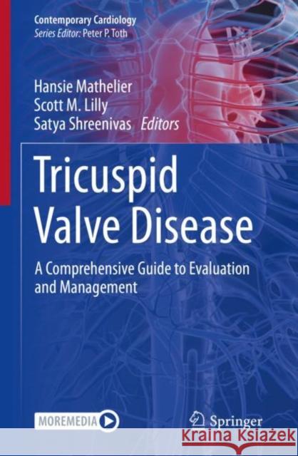 Tricuspid Valve Disease: A Comprehensive Guide to Evaluation and Management Mathelier, Hansie 9783030920456 Springer International Publishing - książka