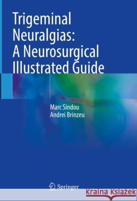 Trigeminal Neuralgias: A Neurosurgical Illustrated Guide Marc Sindou Andrei Brinzeu 9783031251115 Springer - książka