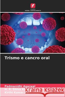 Trismo e cancro oral Padmanidhi Agarwal H. R. Shiv Kirthi Kumar Rai 9786207572557 Edicoes Nosso Conhecimento - książka