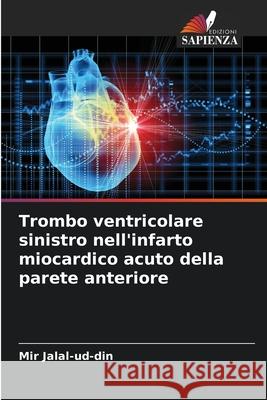 Trombo ventricolare sinistro nell'infarto miocardico acuto della parete anteriore Jalal-ud-din, Mir 9786136285887 Edizioni Sapienza - książka