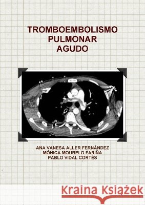 Tromboembolismo Pulmonar Agudo ANA VANESA ALLER FERNANDEZ, PABLO VIDAL CORTES, MONICA MOURELO FARINA 9781470997618 Lulu.com - książka
