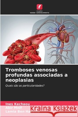 Tromboses venosas profundas associadas a neoplasias Kechaou, Ines, Mnif, Abir, Ben Hassine, Lamia 9786209558528 Edições Nosso Conhecimento - książka