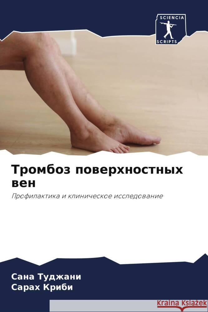 Tromboz powerhnostnyh wen Tudzhani, Sana, Kribi, Sarah 9786204787244 Sciencia Scripts - książka