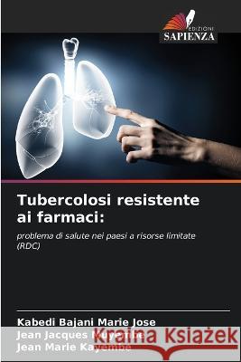 Tubercolosi resistente ai farmaci Kabedi Bajani Marie Jose Jean Jacques Muyembe Jean Marie Kayembe 9786205925898 Edizioni Sapienza - książka