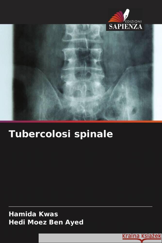 Tubercolosi spinale Hamida Kwas Hedi Moez Ben Ayed  9786205979013 Edizioni Sapienza - książka