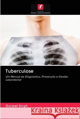 Tuberculose Singh, Gurjeet 9786202871280 Edicoes Nosso Conhecimento - książka