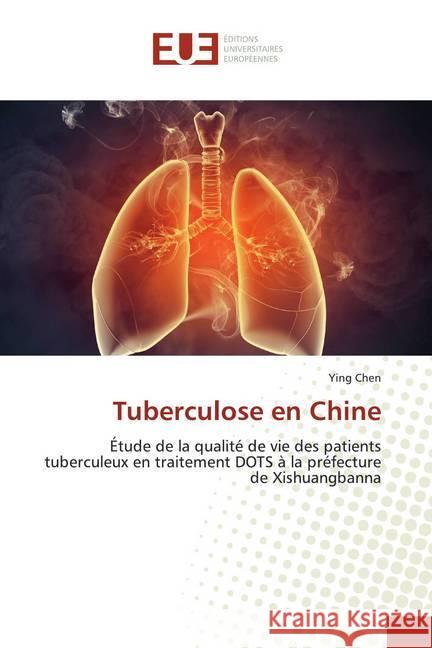 Tuberculose en Chine : Étude de la qualité de vie des patients tuberculeux en traitement DOTS à la préfecture de Xishuangbanna Chen, Ying 9783841733467 Éditions universitaires européennes - książka