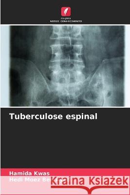 Tuberculose espinal Hamida Kwas Hedi Moez Ben Ayed  9786205978993 Edicoes Nosso Conhecimento - książka