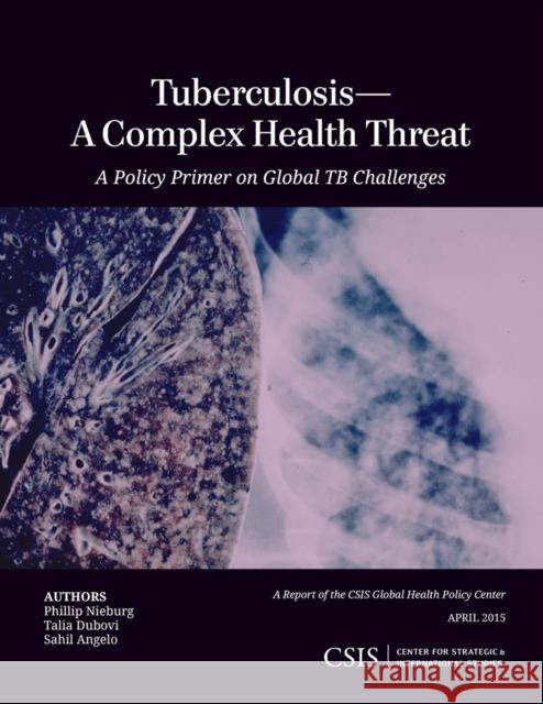 Tuberculosis--A Complex Health Threat: A Policy Primer of Global Tb Challenges Phillip Nieburg Talia Dubovi Sahil Angelo 9781442240940 Rowman & Littlefield Publishers - książka