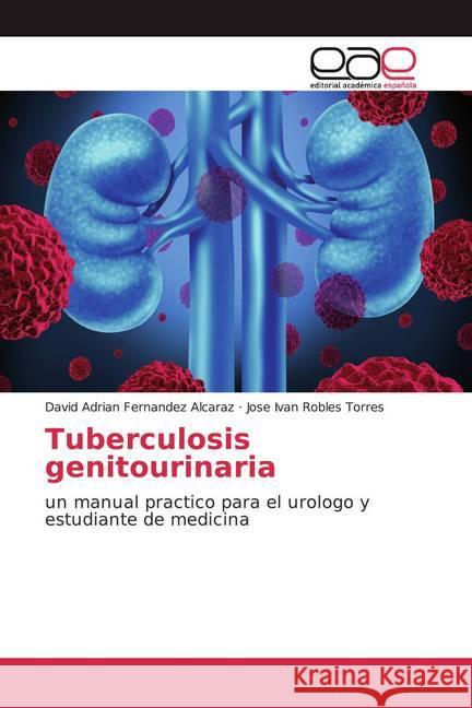 Tuberculosis genitourinaria : un manual practico para el urologo y estudiante de medicina Fernandez Alcaraz, David Adrian; Robles Torres, Jose Ivan 9786139438358 Editorial Académica Española - książka