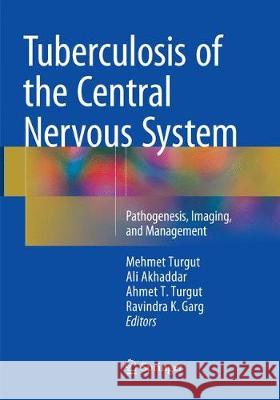 Tuberculosis of the Central Nervous System: Pathogenesis, Imaging, and Management Turgut, Mehmet 9783319844701 Springer - książka