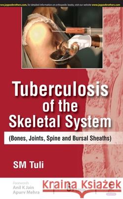 Tuberculosis of the Skeletal System SM Tulsi   9788194709022 Jaypee Brothers Medical Publishers - książka